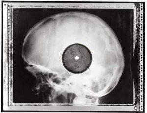 x-ray Russian vinyl (1)